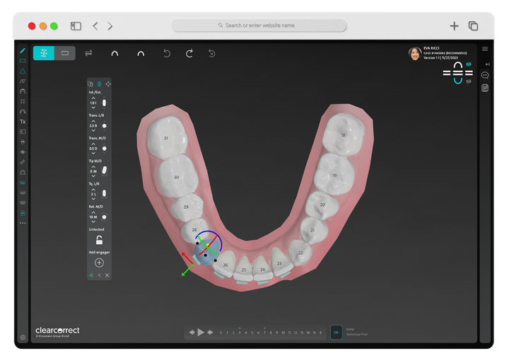 ClearPilot Powerful digital treatment planning